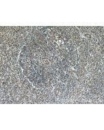 YOD1 Polyclonal antibody 25370-1-AP proteintech