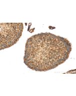 SCML4 Polyclonal antibody 25439-1-AP proteintech