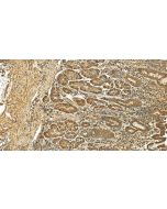 ACSF3 Polyclonal antibody 25484-1-AP proteintech