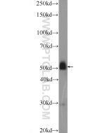 SLC35F2 Polyclonal antibody 25526-1-AP proteintech