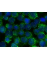 LIX1L Polyclonal antibody 25557-1-AP proteintech