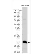 DYDC2 Polyclonal antibody 25568-1-AP proteintech