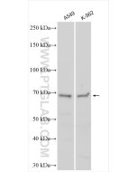 SMPD3 Polyclonal antibody 25613-1-AP proteintech