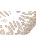ASB13 Polyclonal antibody 25616-1-AP proteintech