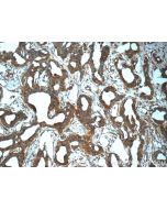 Mammaglobin A Polyclonal antibody 25645-1-AP proteintech