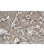 KK-LC-1 Polyclonal antibody 25708-1-AP proteintech