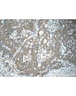 KIAA0841 Polyclonal antibody 25721-1-AP proteintech