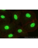 PHF23 Polyclonal antibody 25862-1-AP proteintech