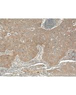 RGS11 Polyclonal antibody 26132-1-AP proteintech