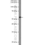 RPS6KB2 Polyclonal antibody 26194-1-AP proteintech