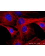 Gamma Tubulin Polyclonal antibody 26195-1-AP proteintech