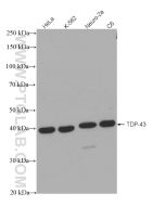 TDP-43 (N-terminal) Recombinant monoclonal antibody Proteintech  80002-1-RR