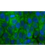 ZNF385A Polyclonal antibody 26288-1-AP proteintech