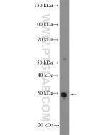 C1orf71 Polyclonal antibody 26322-1-AP proteintech