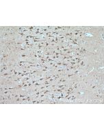 SIRPD Polyclonal antibody 26594-1-AP proteintech