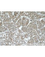 ELAC1 Polyclonal antibody 26639-1-AP proteintech