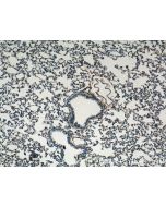TIMP2 Polyclonal antibody 26647-1-AP proteintech