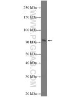 BTN1A1 Polyclonal antibody 26687-1-AP proteintech