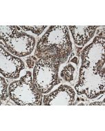 P3H1 Polyclonal antibody 26691-1-AP proteintech