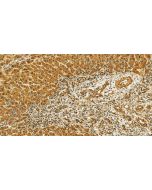 APTX Polyclonal antibody 26747-1-AP proteintech