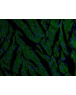 SLC25A12 Polyclonal antibody 26804-1-AP proteintech