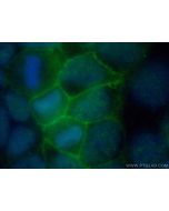 FLVCR1 Polyclonal antibody 26841-1-AP proteintech