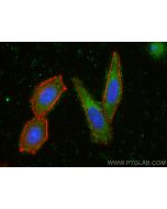 RASGRP1 Polyclonal antibody 26997-1-AP proteintech