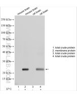 NIPA1 Polyclonal antibody 27077-1-AP proteintech