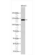 eNOS Polyclonal antibody 27120-1-AP proteintech
