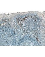 IL-23R Polyclonal antibody 27163-1-AP proteintech