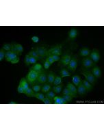 DVL1 Polyclonal antibody 27384-1-AP proteintech