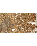 RanGAP1 Polyclonal antibody 27405-1-AP proteintech