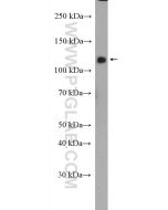 CNTNAP3 Polyclonal antibody 27410-1-AP proteintech