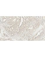Alpha Taxilin Polyclonal antibody 27558-1-AP proteintech