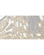 UST Polyclonal antibody 27578-1-AP proteintech