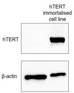TERT Polyclonal antibody 27586-1-AP proteintech