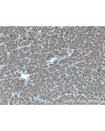 TAPT1 Polyclonal antibody 27657-1-AP proteintech