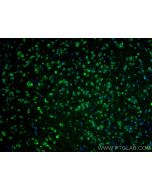 SALL1 Polyclonal antibody 27761-1-AP proteintech