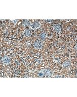 C22orf25 Polyclonal antibody 27846-1-AP proteintech