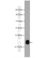 SMIM1 Polyclonal antibody 27849-1-AP proteintech