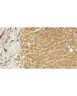 MED23 Polyclonal antibody 27850-1-AP proteintech