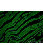 Titin Polyclonal antibody 27867-1-AP proteintech