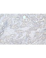 TRIB1 Polyclonal antibody 27899-1-AP proteintech