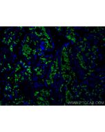 Band 3/AE 1 Polyclonal antibody 28131-1-AP proteintech
