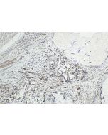 FSTL3/FLRG Polyclonal antibody 28218-1-AP proteintech