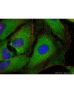 mTOR Polyclonal antibody 28273-1-AP proteintech