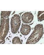 KIF2C Polyclonal antibody 28372-1-AP proteintech