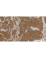 MSTO1 Polyclonal antibody 28400-1-AP proteintech