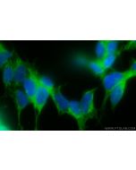 DST Polyclonal antibody 28438-1-AP proteintech