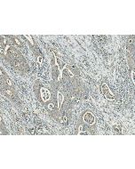 GRP Polyclonal antibody 28482-1-AP proteintech